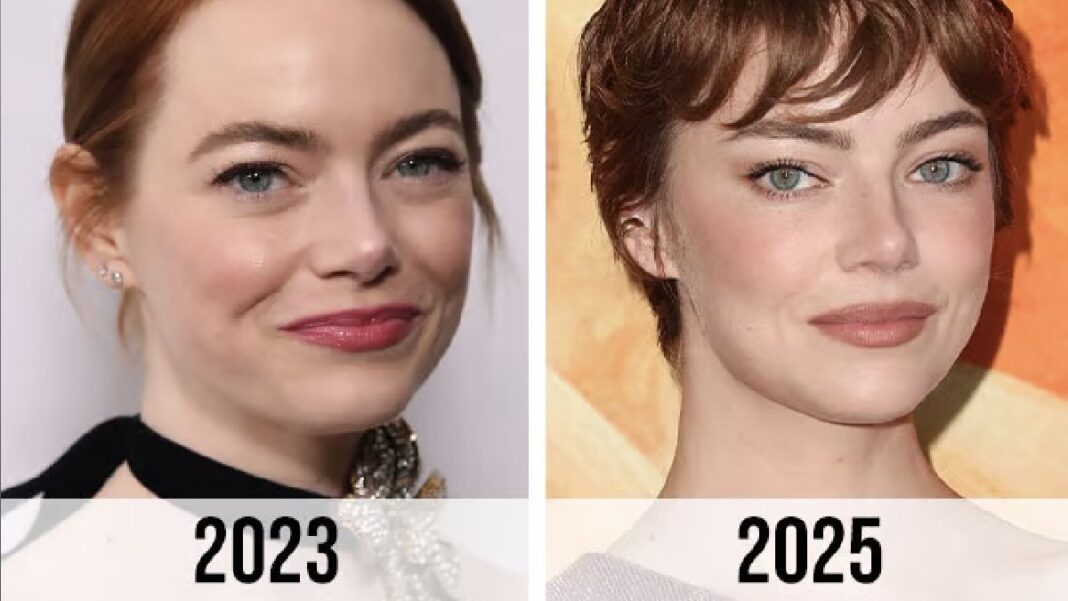Emma Stone’s Fans Shocked by Her New Face
