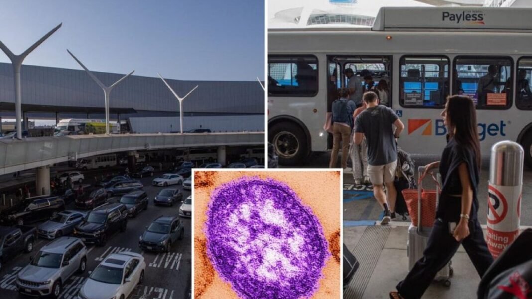 Measles Alert at LAX Amid World Cup Travel Measles Alert at LAX Amid World Cup Travel
